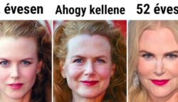 Egy plasztikai sebész megmutatta, hogyan nézne ki 10 híres nő, ha hétköznapi emberekként öregednének