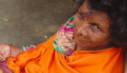 Boszorkánynak titulálták azt a 63 éves indiai nőt, aki 31 ujjal született – Íme a képek