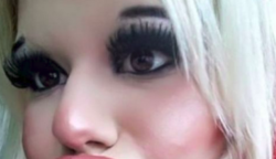 Ez a fiatal nő a világ legnagyobb ajkaira vágyik – Így nézett ki a plasztikai műtétek előtt