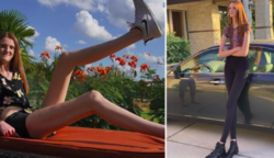 Egy 17 éves lány lábai miatt került be a Guinness Rekordok Könyvébe