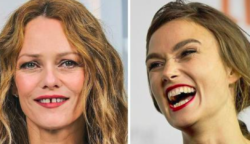 16 híresség, akik felvállalják a tökéletesen tökéletlen mosolyukat