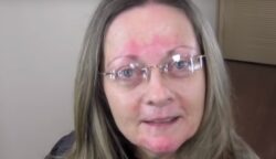 A szemüveges, rosaceás arcú 60 éves hölgy ragaszkodott hozzá, hogy csak úgy alakítsák át, hogy természetes maradjon: 25 évet “faragtak le róla”