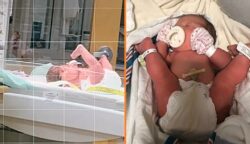 Az anya posztol egy videót a babájáról, aki a lábaival a feje köré született, és a szakértők megmagyarázzák ezt